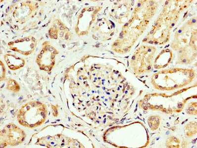 CPT2 Antibody - Immunohistochemistry image at a dilution of 1:200 and staining in paraffin-embedded human kidney tissue performed on a Leica BondTM system. After dewaxing and hydration, antigen retrieval was mediated by high pressure in a citrate buffer (pH 6.0) . Section was blocked with 10% normal goat serum 30min at RT. Then primary antibody (1% BSA) was incubated at 4 °C overnight. The primary is detected by a biotinylated secondary antibody and visualized using an HRP conjugated SP system.