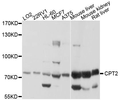 CPT2 Antibody - Western blot analysis of extracts of various cell lines, using CPT2 antibody at 1:1000 dilution. The secondary antibody used was an HRP Goat Anti-Rabbit IgG (H+L) at 1:10000 dilution. Lysates were loaded 25ug per lane and 3% nonfat dry milk in TBST was used for blocking. An ECL Kit was used for detection and the exposure time was 1s.