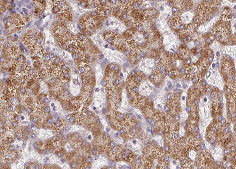 CPT2 Antibody - 1:100 staining human liver tissue by IHC-P. The tissue was formaldehyde fixed and a heat mediated antigen retrieval step in citrate buffer was performed. The tissue was then blocked and incubated with the antibody for 1.5 hours at 22°C. An HRP conjugated goat anti-rabbit antibody was used as the secondary.
