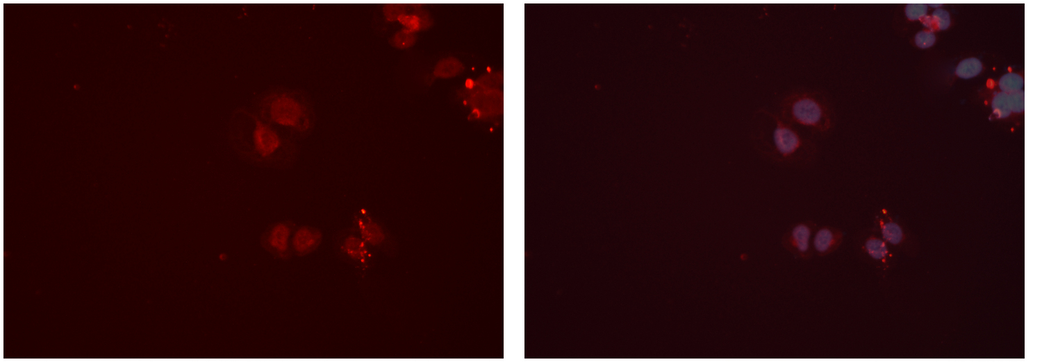 CPT2 Antibody - Staining HeLa cells by IF/ICC. The samples were fixed with PFA and permeabilized in 0.1% Triton X-100, then blocked in 10% serum for 45 min at 25°C. The primary antibody was diluted at 1:200 and incubated with the sample for 1 hour at 37°C. An Alexa Fluor 594 conjugated goat anti-rabbit IgG (H+L) antibody, diluted at 1/600 was used as secondary antibody.