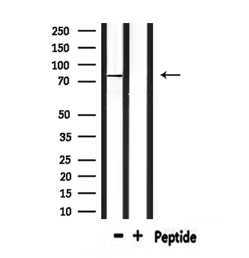 CPT2 Antibody - Western blot analysis of extracts of rat kidney using CPT2 antibody.