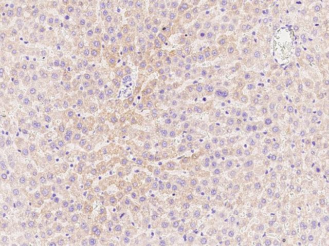 CPT2 Antibody - Immunochemical staining CPT2 in mouse liver with rabbit polyclonal antibody at 1:1000 dilution, formalin-fixed paraffin embedded sections.