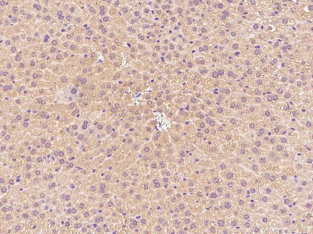 CPT2 Antibody - Immunochemical staining CPT2 in rat liver with rabbit polyclonal antibody at 1:1000 dilution, formalin-fixed paraffin embedded sections.