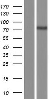 CPT2 Protein - Western validation with an anti-DDK antibody * L: Control HEK293 lysate R: Over-expression lysate