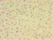 CPVL Antibody - Immunohistochemistry of paraffin-embedded human liver tissue using antibody at 1:100 dilution.  This image was taken for the unconjugated form of this product. Other forms have not been tested.
