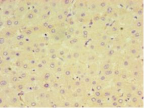 CPVL Antibody - Immunohistochemistry of paraffin-embedded human liver tissue using antibody at 1:100 dilution.  This image was taken for the unconjugated form of this product. Other forms have not been tested.
