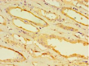 CPVL Antibody - Immunohistochemistry of paraffin-embedded human kidney tissue using antibody at 1:100 dilution.  This image was taken for the unconjugated form of this product. Other forms have not been tested.