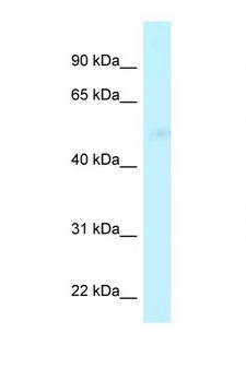 CPVL Antibody - CPVL antibody western blot of MDA-MB-435S Cell lysate. Antibody concentration 1 ug/ml.  This image was taken for the unconjugated form of this product. Other forms have not been tested.