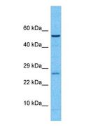 CPVL Antibody - Western blot of CPVL Antibody with human Fetal Liver lysate.  This image was taken for the unconjugated form of this product. Other forms have not been tested.