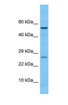 CPVL Antibody - Western blot of CPVL Antibody with human Fetal Liver lysate.  This image was taken for the unconjugated form of this product. Other forms have not been tested.