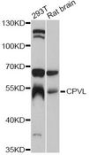 CPVL Antibody - Western blot analysis of extracts of various cell lines, using CPVL antibody at 1:3000 dilution. The secondary antibody used was an HRP Goat Anti-Rabbit IgG (H+L) at 1:10000 dilution. Lysates were loaded 25ug per lane and 3% nonfat dry milk in TBST was used for blocking. An ECL Kit was used for detection and the exposure time was 5s.