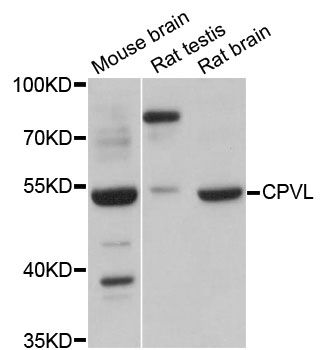 CPVL Antibody - Western blot analysis of extracts of various cell lines, using CPVL antibody at 1:3000 dilution. The secondary antibody used was an HRP Goat Anti-Rabbit IgG (H+L) at 1:10000 dilution. Lysates were loaded 25ug per lane and 3% nonfat dry milk in TBST was used for blocking. An ECL Kit was used for detection and the exposure time was 5s.