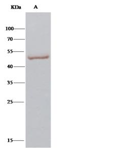 CPVL Antibody - CPVL was immunoprecipitated using: Lane A: 0.5 mg HepG2 Whole Cell Lysate. 2 uL anti-CPVL rabbit polyclonal antibody and 15 ul of 50% Protein G agarose. Primary antibody: Anti-CPVL rabbit polyclonal antibody, at 1:100 dilution. Secondary antibody: Clean-Blot IP Detection Reagent (HRP) at 1:1000 dilution. Developed using the DAB staining technique. Performed under reducing conditions. Predicted band size: 54 kDa. Observed band size: 54 kDa.
