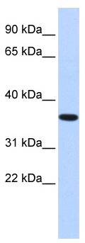 CPXCR1 / CT77 Antibody - Western analysis of fetal brain lysate.  This image was taken for the unconjugated form of this product. Other forms have not been tested.