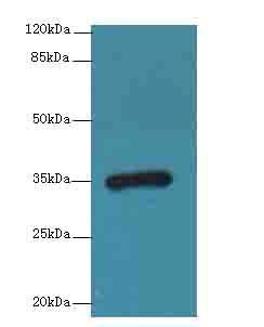 CPXCR1 / CT77 Antibody - Western blot. All lanes: CPXCR1 antibody at 5 ug/ml+Mos- brain tissue Goat polyclonal to rabbit at 1:10000 dilution. Predicted band size: 35 kDa. Observed band size: 35 kDa.