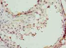 CPXCR1 / CT77 Antibody - Immunohistochemistry of paraffin-embedded human testis tissue using antibody at dilution of 1:100.