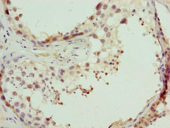 CPXCR1 / CT77 Antibody - Immunohistochemistry of paraffin-embedded human testis tissue using CPXCR1 Antibody at dilution of 1:100
