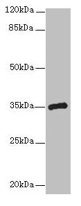CPXCR1 / CT77 Antibody - Western blot All lanes: CPXCR1 antibody at 5µg/ml + Mouse brain tissue Secondary Goat polyclonal to rabbit IgG at 1/10000 dilution Predicted band size: 35 kDa Observed band size: 35 kDa