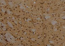 CPXCR1 / CT77 Antibody - 1:100 staining rat brain tissue by IHC-P. The sample was formaldehyde fixed and a heat mediated antigen retrieval step in citrate buffer was performed. The sample was then blocked and incubated with the antibody for 1.5 hours at 22°C. An HRP conjugated goat anti-rabbit antibody was used as the secondary.