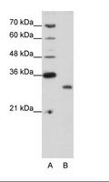 CPXCR1 / CT77 Antibody - A: Marker, B: Jurkat Cell Lysate.  This image was taken for the unconjugated form of this product. Other forms have not been tested.