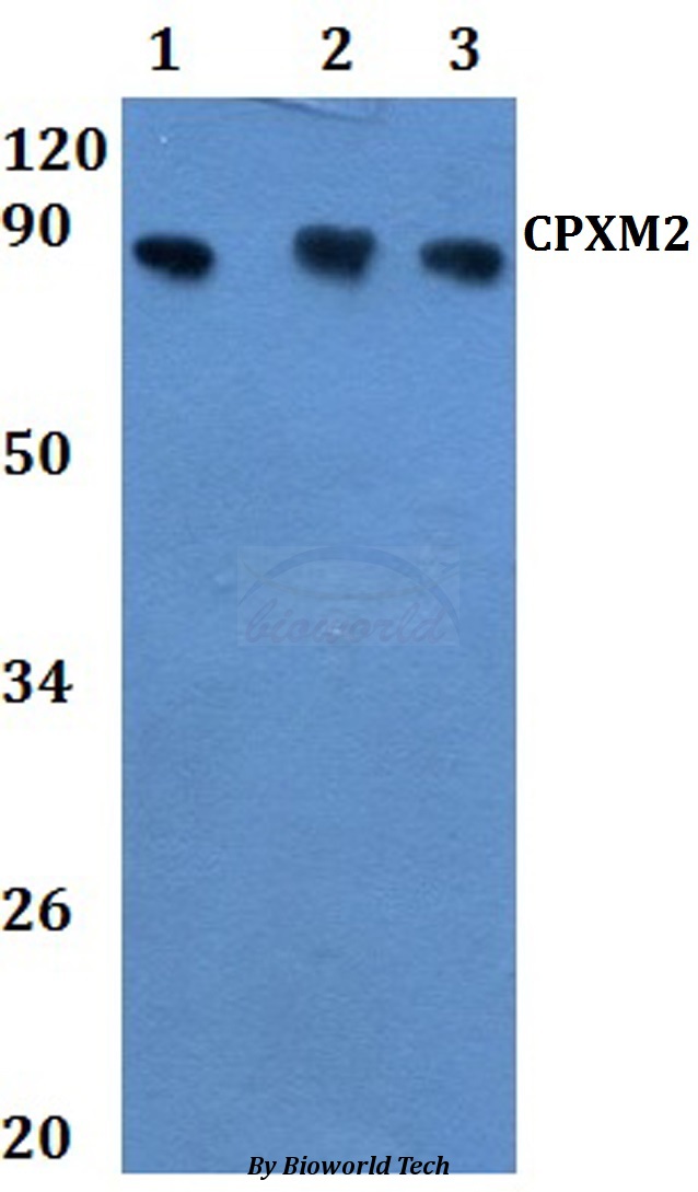 CPXM2 Antibody - Western blot of CA8 antibody at 1:500 Line1:MCF-7 whole cell lysate Line2:H9C2 whole cell lysate Line3:sp20 whole cell lysate.