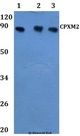 CPXM2 Antibody - Western blot of CA8 antibody at 1:500 Line1:MCF-7 whole cell lysate Line2:H9C2 whole cell lysate Line3:sp20 whole cell lysate.