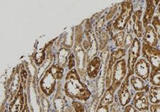 CPXM2 Antibody - 1:100 staining mouse kidney tissue by IHC-P. The sample was formaldehyde fixed and a heat mediated antigen retrieval step in citrate buffer was performed. The sample was then blocked and incubated with the antibody for 1.5 hours at 22°C. An HRP conjugated goat anti-rabbit antibody was used as the secondary.