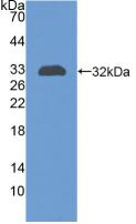 CR1 / CD35 Antibody - Western Blot; Sample: Recombinant CR1, Human.