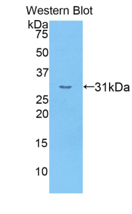 CR1 / CD35 Antibody - Western blot of recombinant CR1 / CD35.  This image was taken for the unconjugated form of this product. Other forms have not been tested.