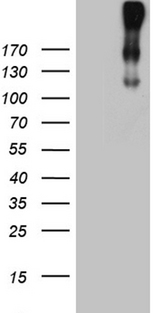 CR1 / CD35 Antibody - HEK293T cells were transfected with the pCMV6-ENTRY control. (Left lane) or pCMV6-ENTRY. (Right lane) cDNA for 48 hrs and lysed. Equivalent amounts of cell lysates. (5 ug per lane) were separated by SDS-PAGE and immunoblotted with anti-CR1. (1:2000)