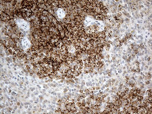 CR1 / CD35 Antibody - Immunohistochemical staining of paraffin-embedded Human spleen tissue within the normal limits using anti-CR1 mouse monoclonal antibody. (Heat-induced epitope retrieval by 1mM EDTA in 10mM Tris buffer. (pH8.5) at 120°C for 3 min. (1:500)