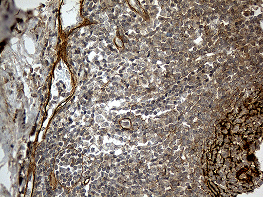 CR1 / CD35 Antibody - Immunohistochemical staining of paraffin-embedded Human tonsil within the normal limits using anti-CR1 mouse monoclonal antibody. (Heat-induced epitope retrieval by 1mM EDTA in 10mM Tris buffer. (pH8.5) at 120°C for 3 min. (1:500)