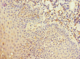 CR1 / CD35 Antibody - Immunohistochemistry of paraffin-embedded human tonsil tissue at dilution 1:100