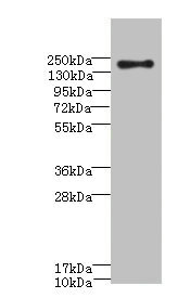 CR1 / CD35 Antibody - Western blot All Lanes: CR1antibody IgG at 3.15ug/ml+ 293T whole cell lysate Secondary Goat polyclonal to rabbit IgG at 1/10000 dilution Predicted band size: 224 kDa Observed band size: 224 kDa