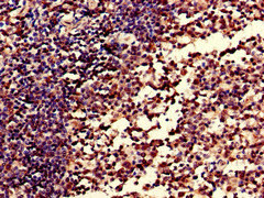 CR1 / CD35 Antibody - Immunohistochemistry of paraffin-embedded human tonsil tissue at dilution of 1:100