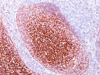 CR1 / CD35 Antibody - Formalin-fixed, paraffin-embedded human tonsil stained with CD35 antibody (CR1/802).  This image was taken for the unmodified form of this product. Other forms have not been tested.