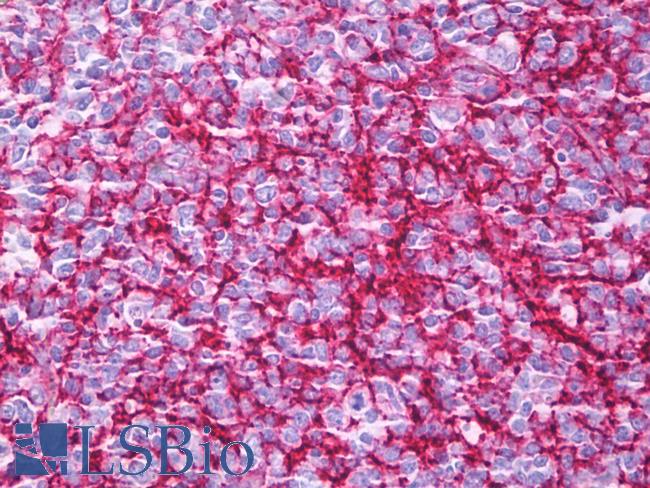CR1 / CD35 Antibody - Anti-CD35 antibody IHC of human tonsil, germinal center. Immunohistochemistry of formalin-fixed, paraffin-embedded tissue after heat-induced antigen retrieval. Antibody concentration 10 ug/ml.  This image was taken for the unmodified form of this product. Other forms have not been tested.