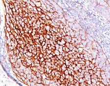 CR1 / CD35 Antibody - CD35 antibody E11 immunohistochemistry.  This image was taken for the unmodified form of this product. Other forms have not been tested.