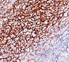 CR1 / CD35 Antibody - Formalin-fixed, paraffin-embedded human tonsil stained with CD35 antibody (SPM554).  This image was taken for the unmodified form of this product. Other forms have not been tested.
