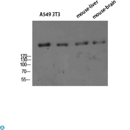 CR1 / CD35 Antibody - Western Blot (WB) analysis of A549 3T3 Mouse Liver Mouse Brain cells using CD35 Polyclonal Antibody diluted at 1:800.