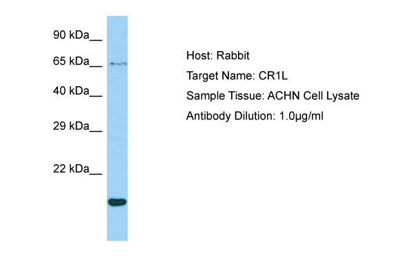 CR1L / CRRY Antibody -  This image was taken for the unconjugated form of this product. Other forms have not been tested.
