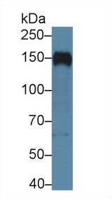 CR2 / CD21 Antibody - Western Blot; Sample: Human Raji cell lysate; Primary Ab: 5µg/ml Rabbit Anti-Human CR2 Antibody Second Ab: 0.2µg/mL HRP-Linked Caprine Anti-Rabbit IgG Polyclonal Antibody