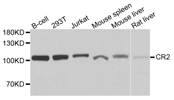 CR2 / CD21 Antibody - Western blot analysis of extracts of various cells.