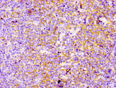 CR2 / CD21 Antibody - IHC image of CY5710 diluted at 1:100 and staining in paraffin-embedded human tonsil tissue performed on a Leica BondTM system. After dewaxing and hydration, antigen retrieval was mediated by high pressure in a citrate buffer (pH 6.0). Section was blocked with 10% normal Goat serum 30min at RT. Then primary antibody (1% BSA) was incubated at 4°C overnight. The primary is detected by a biotinylated Secondary antibody and visualized using an HRP conjugated SP system.