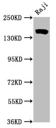 CR2 / CD21 Antibody - Western Blot Positive WB detected in:Raji whole cell lysate All Lanes:CD21 antibody at 0.55µg/ml Secondary Goat polyclonal to rabbit IgG at 1/50000 dilution Predicted band size: 155 KDa Observed band size: 155 KDa