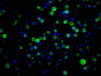 CR2 / CD21 Antibody - Immunofluorescence staining of Raji cells with CD21 Antibody at 1:34,counter-stained with DAPI. The cells were fixed in 4% formaldehyde, permeabilized using 0.2% Triton X-100 and blocked in 10% normal Goat Serum. The cells were then incubated with the antibody overnight at 4°C.The secondary antibody was Alexa Fluor 488-congugated AffiniPure Goat Anti-Rabbit IgG (H+L).