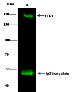 CR2 / CD21 Antibody - CD21 was immunoprecipitated using: Lane A: 0.5 mg Daudi Whole Cell Lysate. 0.5 uL anti-CD21 rabbit polyclonal antibody and 15 ul of 50% Protein G agarose. Primary antibody: Anti-CD21 rabbit polyclonal antibody, at 1:350 dilution. Secondary antibody: Dylight 800-labeled antibody to rabbit IgG (H+L), at 1:5000 dilution. Developed using the odssey technique. Performed under reducing conditions. Predicted band size: 170 kDa. Observed band size: 170 kDa.
