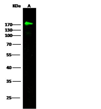 CR2 / CD21 Antibody - Anti-CD21 rabbit polyclonal antibody at 1:500 dilution. Lane A: 293T Membrane Lysate. Lysates/proteins at 20 ug per lane. Secondary: Goat Anti-Rabbit IgG H&L (Dylight800) at 1/10000 dilution. Developed using the Odyssey technique. Performed under reducing conditions. Predicted band size: 113 kDa. Observed band size: 170 kDa.