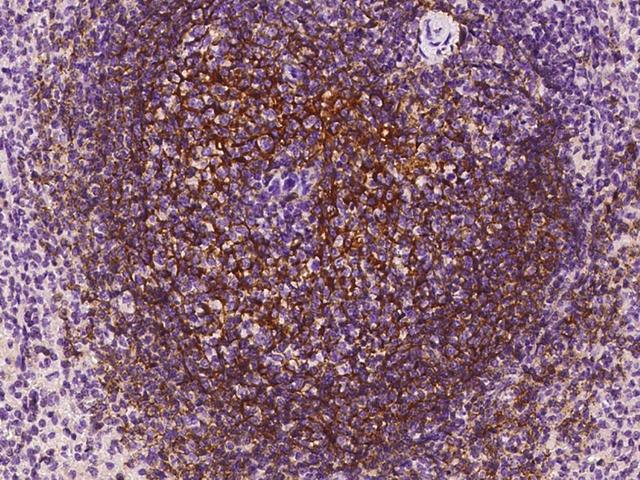 CR2 / CD21 Antibody - Immunochemical staining CD21 in cynomolgus spleen with rabbit polyclonal antibody at 1:300 dilution, formalin-fixed paraffin embedded sections.