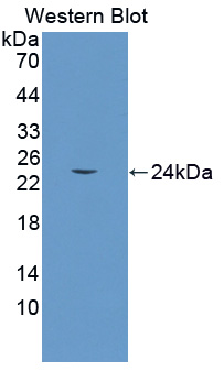 CR6 / GADD45G Antibody - Western blot of CR6 / GADD45G antibody.